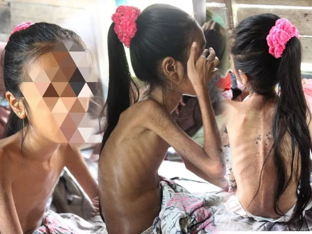 Foto: Putri Warga Meunasah Trieng Lhoksukon di kutip di Laman kitabisa.com