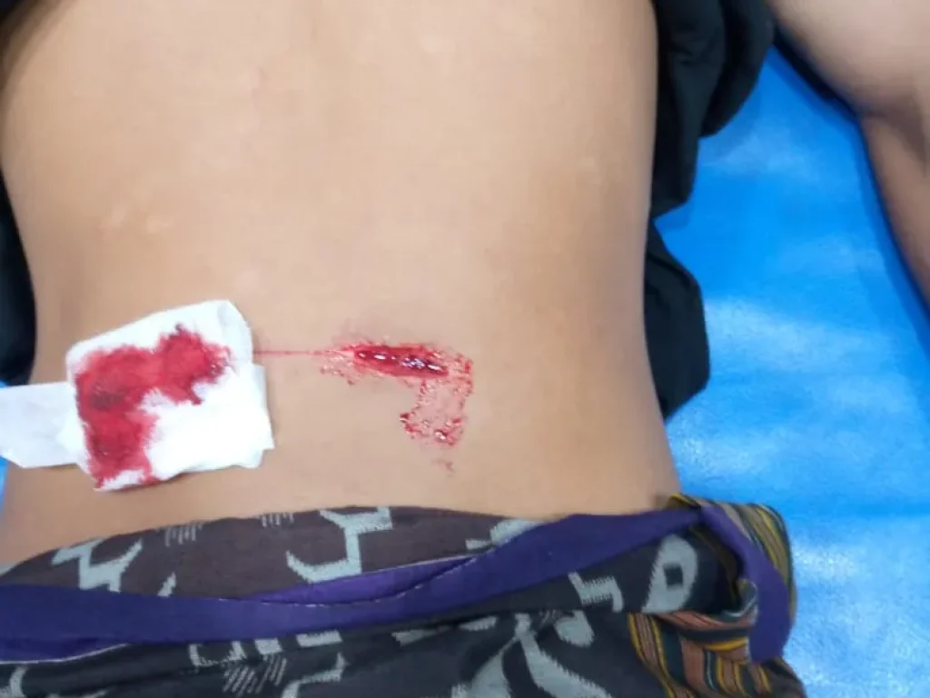 Foto: Humas Polres Lhokseumawe